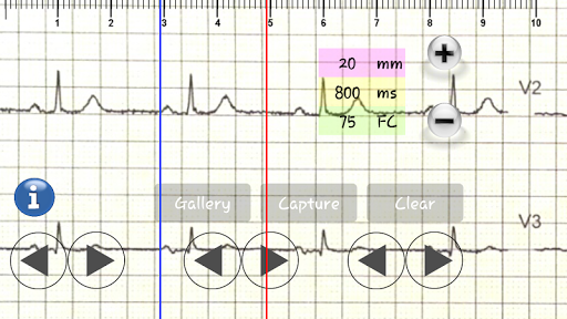 【免費醫療App】ECG practical Demo-APP點子