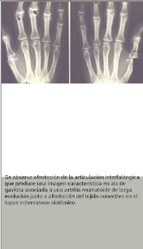 【免費醫療App】Radiología-APP點子