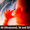 4d Ultrasound, 3d and 2d icon