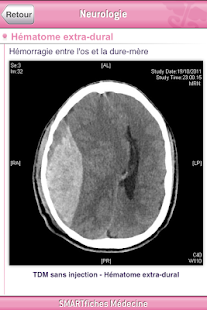 How to get SMARTfiches Neurologie Free 1.04 unlimited apk for bluestacks