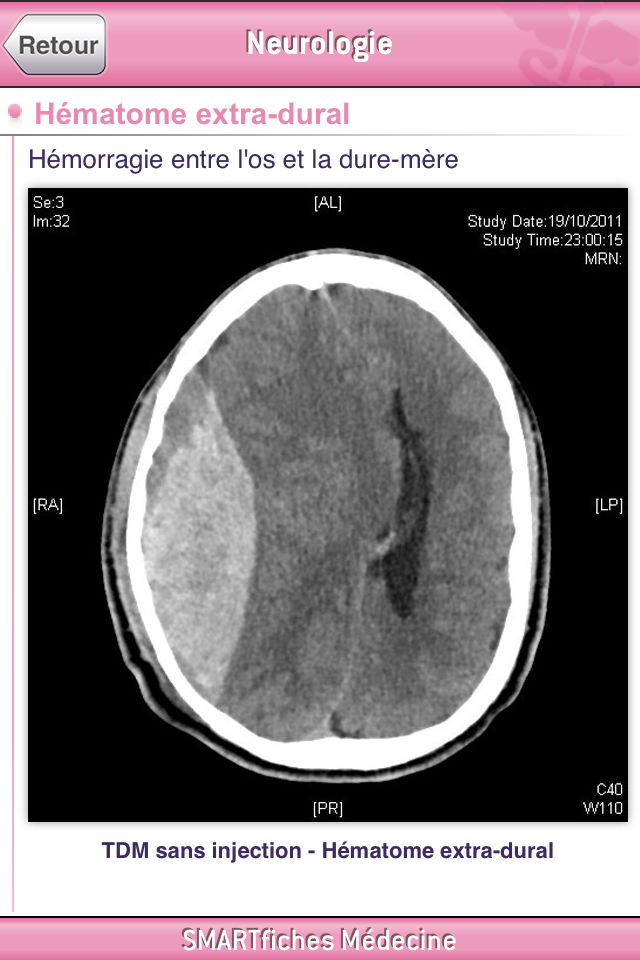 SMARTfiches Neurologie Free Screen 2