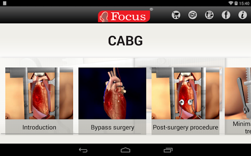 免費下載醫療APP|Coronary Artery Bypass Graft app開箱文|APP開箱王