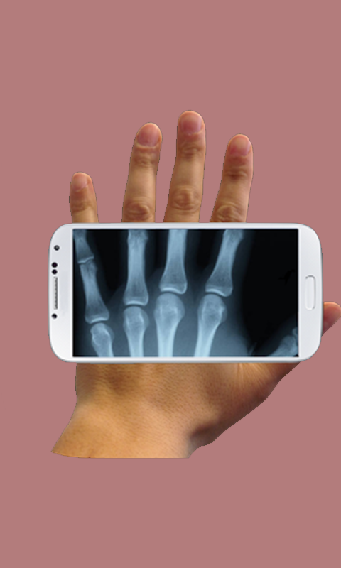 X-ray Cam Prank Screen 2