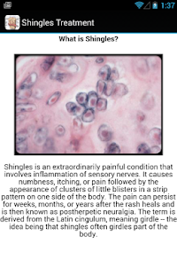 How to download Shingles Symptoms Treatment 1.0 apk for bluestacks