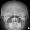 Human X-ray Anatomy