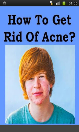 How To Get Rid Of Acne