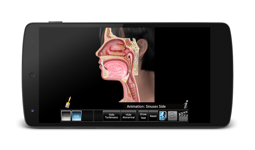 Sinus ID Screen 3
