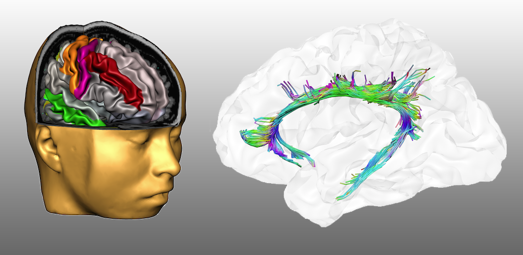Мозг андроида. Звук в 3d приложении картинка. Ice Brain. One Brain. Приложение brain