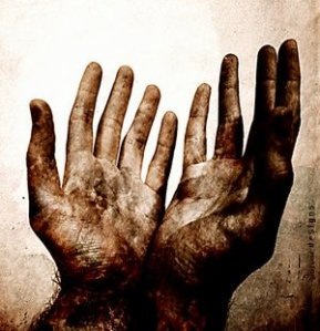 [nailscarredhands4.jpg]