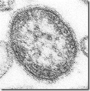180px-Measles_virus