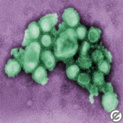 [virus influenza A[6].jpg]