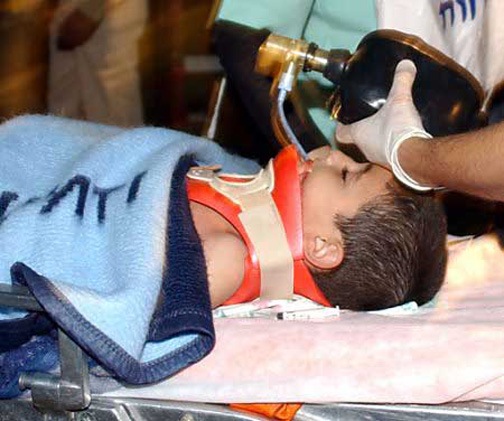[gaza-attack-wounded-child-2-2[4].jpg]
