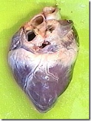 intact_heart