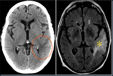 CT scan dan MRI pd pasien sama
