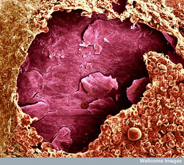  Looking-at-the-World-through-a-Microscope-wound.jpg