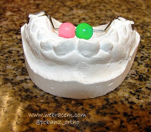 [bluegrass dental braces[3].jpg]