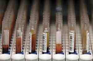 Blood Samples