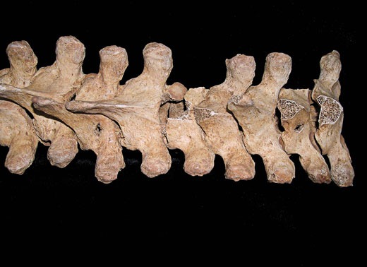 [Vikings-vertebrae-punctures-10[5].jpg]