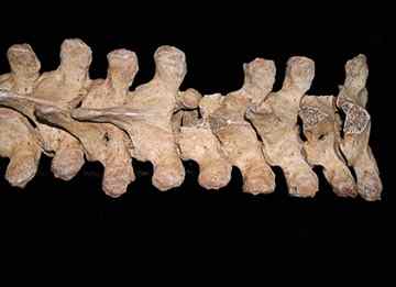 Puncture marks in the vertebrae were suggestive of stab wounds.