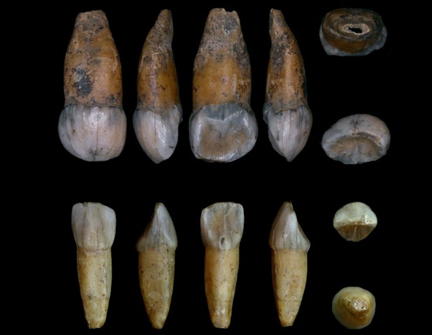 [neanderthal-teeth-zoom[5].jpg]