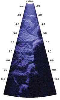 In June 2010, acoustic imaging technology was introduced to archaeological survey of the site, revealing hitherto unknown detail of the underwater remains.