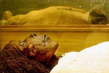 Scientists found no signs of cancer in their extensive study of mummies apart from one isolated case.