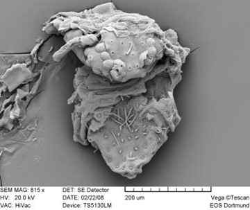 This is a REM picture of a tiny coccid dissolved from the amber. Credit: (c) University of Bonn