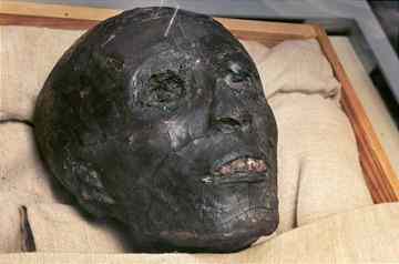 The face of the linen-wrapped mummy of King Tut. (Associated Press)