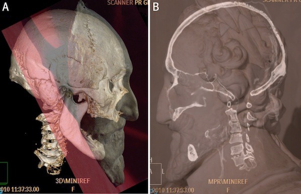[henrysculptureoverlay101214026.jpg]