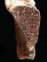[peruchildsacrificecutbreastbone_3067[1].jpg]