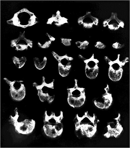 [28CANCER1popup5.jpg]