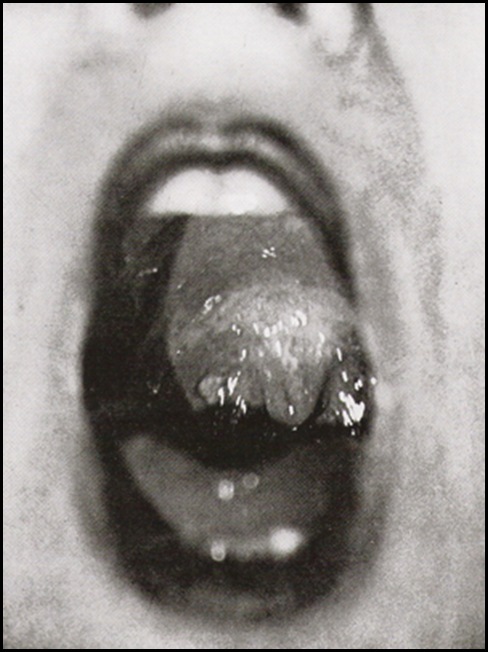 Jacques-André Boiffard, Mouth , Documents No5, 1929