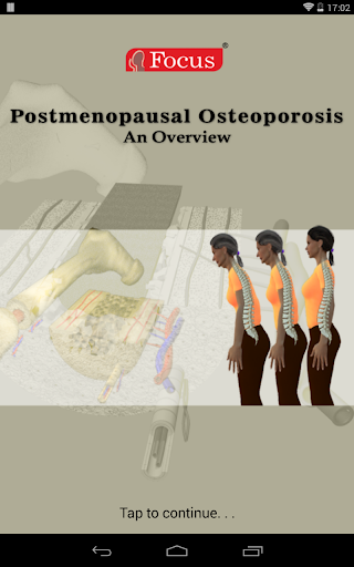 Postmenopausal Osteoporosis