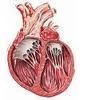 [miocardiopatia-dilatativa[5].jpg]