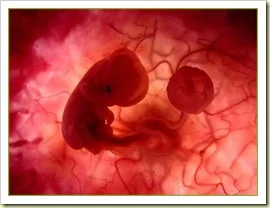 aborto1