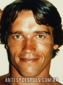 Arnold Schwarzenegger, 1977 
