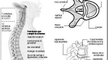 Estenosis del canal de la columna lumbar: una causa común de dolor en la espalda y en las piernas