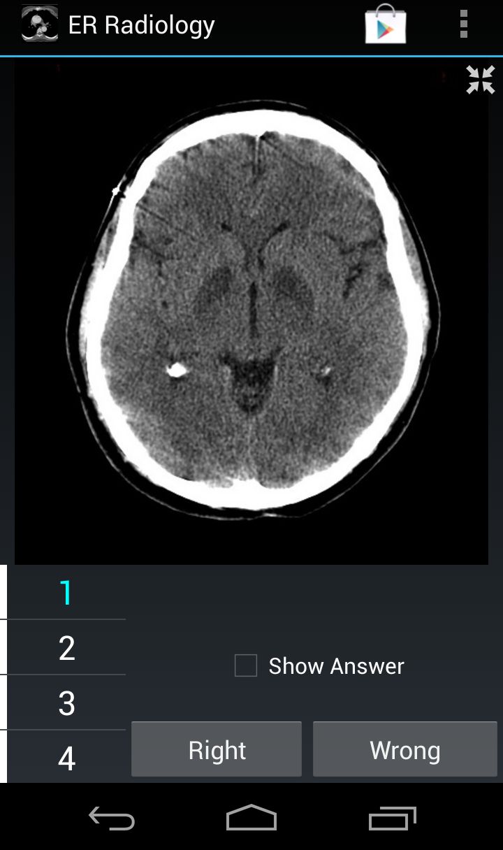 Radiology Flashcards: ER Screen 2