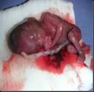 images aborto 7