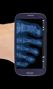 Xray- Prank Screenshots 3