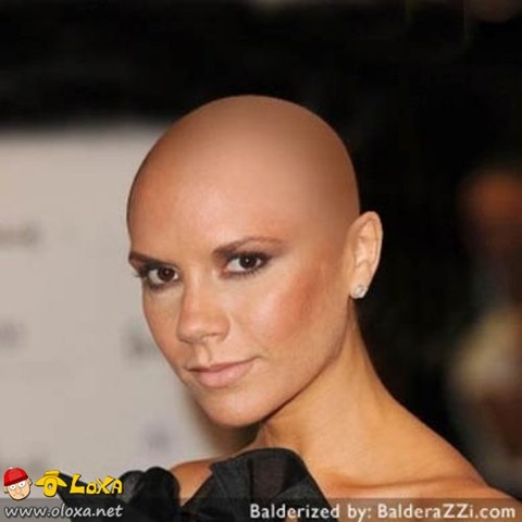 [celebrities-photoshopped-bald-21[2].jpg]