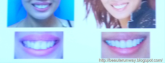 [dental makeover patient[2].jpg]
