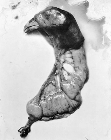 Frederick Sommer 