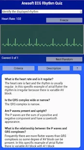 EKG practice test – ECG Quiz