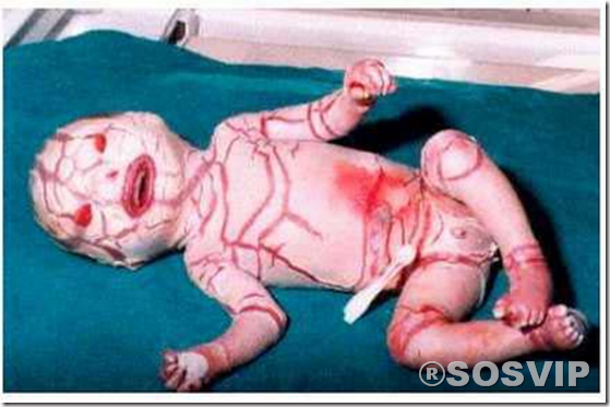 Bebês anormalidades anomalias.jpg (4)