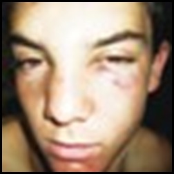 Scholtz Arnold 16 beaten at NoordKaap High School Kimberley by pupils who steal food