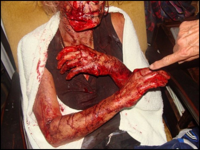 Theresa Eksteen Jan 26 2010 Stilfontein farm attacked by man with panga - survived