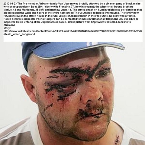 [Van Vuuren Marthinus and family beaten up Jagersfontein six man black gang March 23 2010[5].jpg]