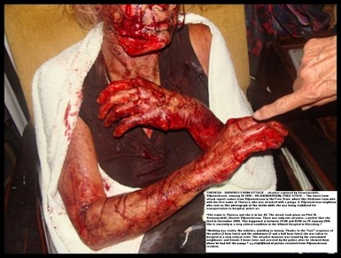 Eksteen Theresa panga attack victim Vermaansdrift Viljoenskroon AH Jan 25 2010