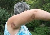 [White woman attacked on StWinifred KZN beach 26Jan2011[5].jpg]
